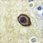 Anti-CD115 (pY561) Antibody
